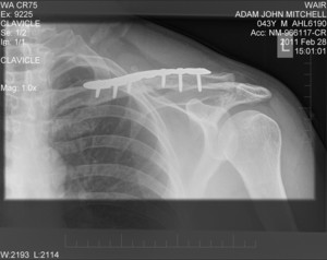 Img0001screw