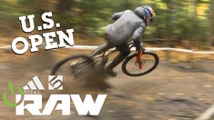 Vital RAW – 2025 U.S. Open of Mountain Biking