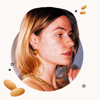 accutane